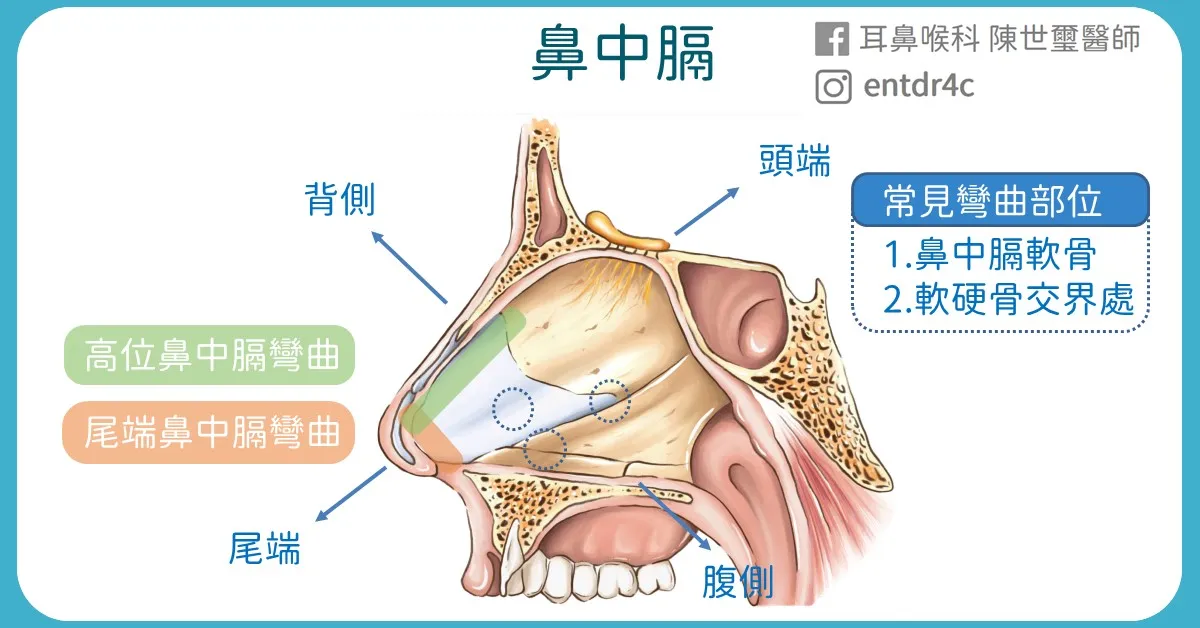02 尾端鼻中膈在哪裡