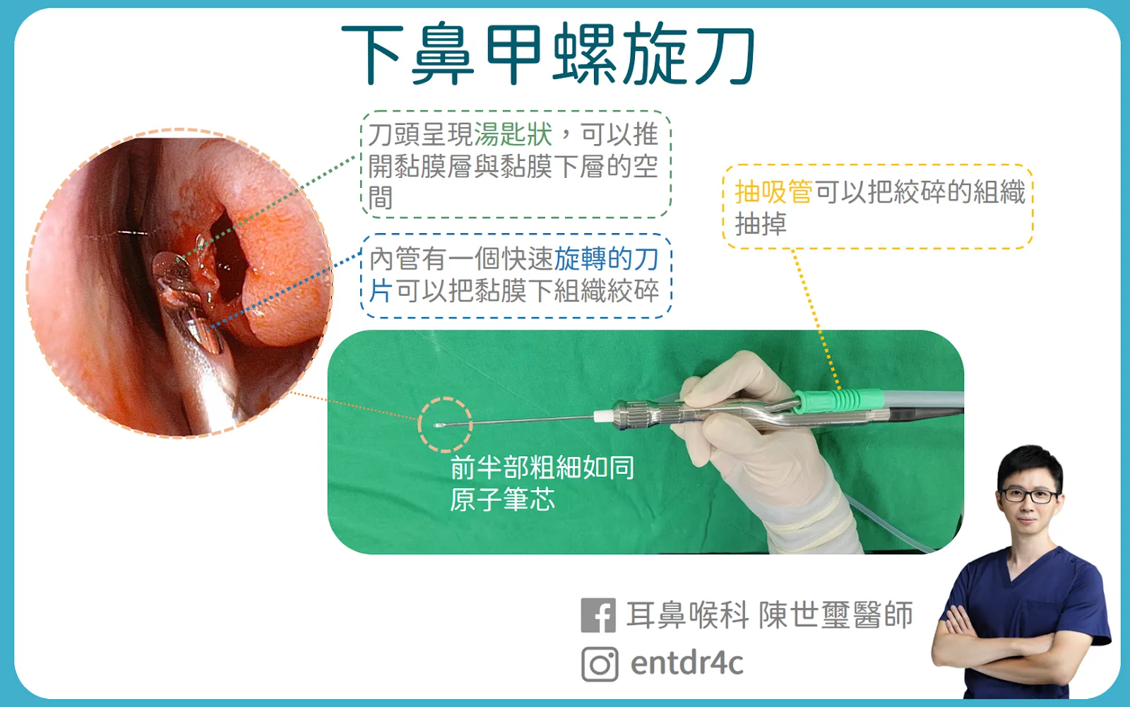 下鼻甲微創螺旋刀