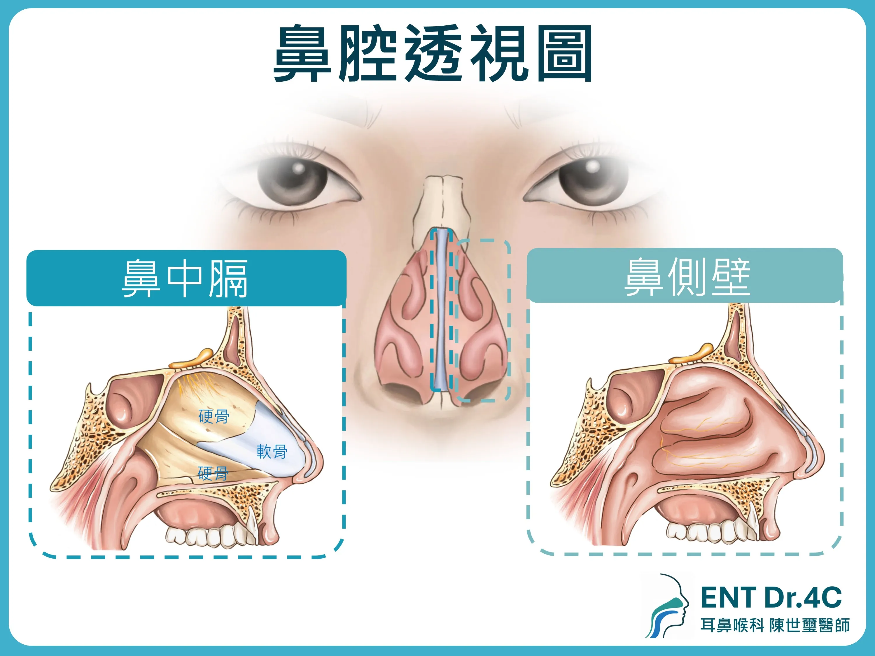 鼻腔透視圖：鼻中膈由軟骨與硬骨組成，鼻側壁可見鼻甲構造
