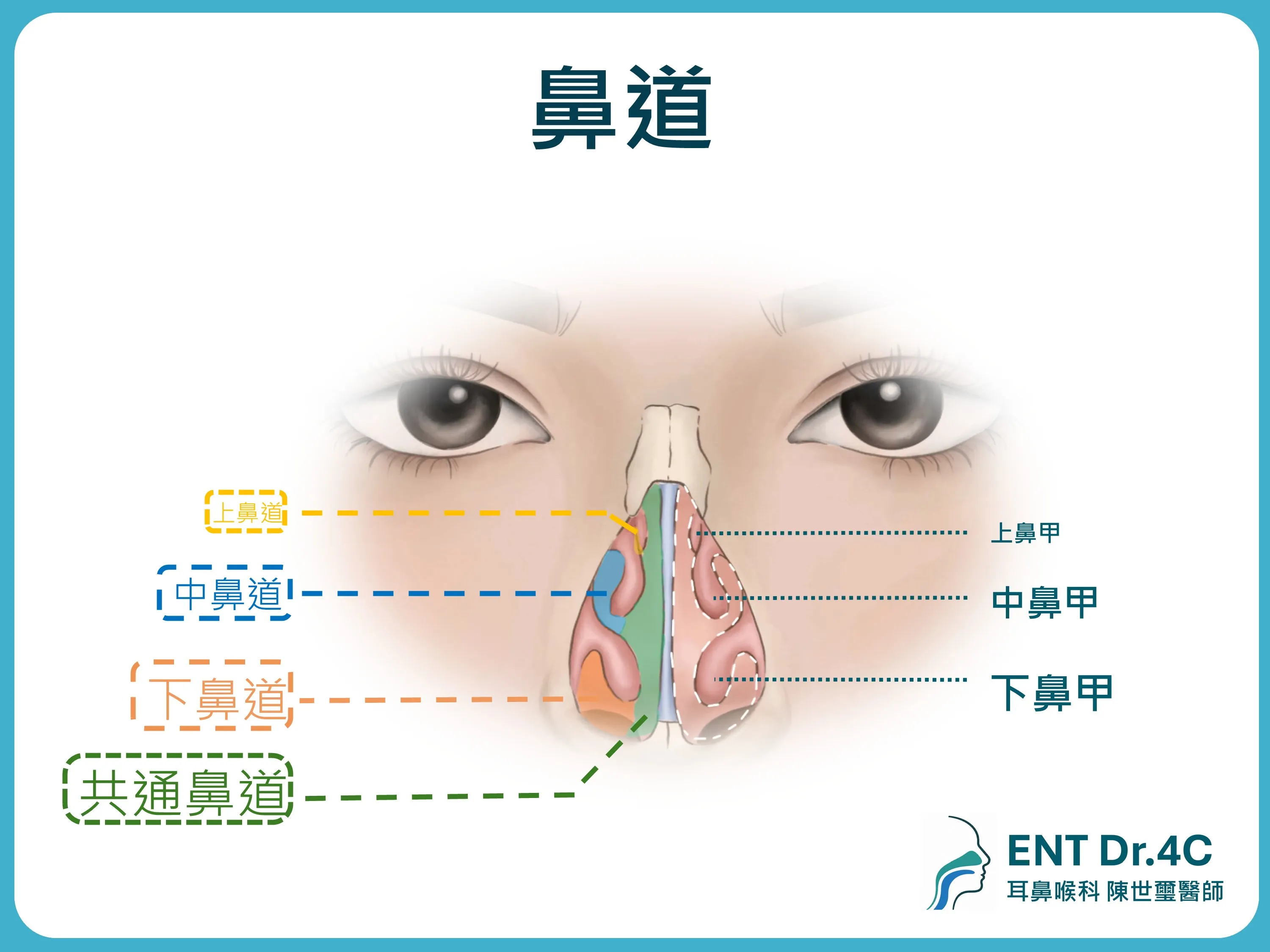鼻道示意圖：上鼻道、中鼻道、下鼻道與共通鼻道