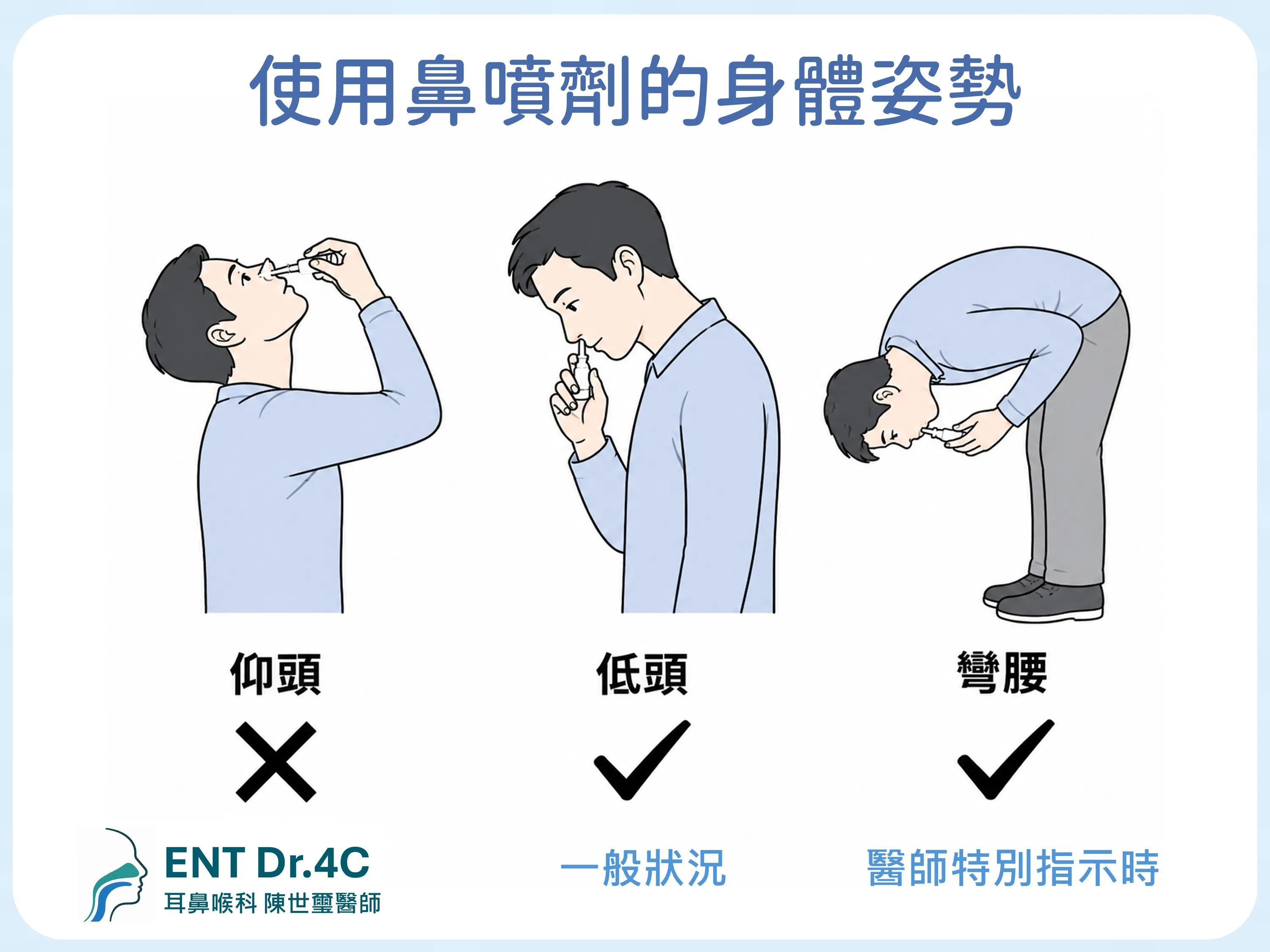 使用鼻噴劑的身體姿勢：仰頭錯誤，一般狀況低頭，醫師特別指示時彎腰