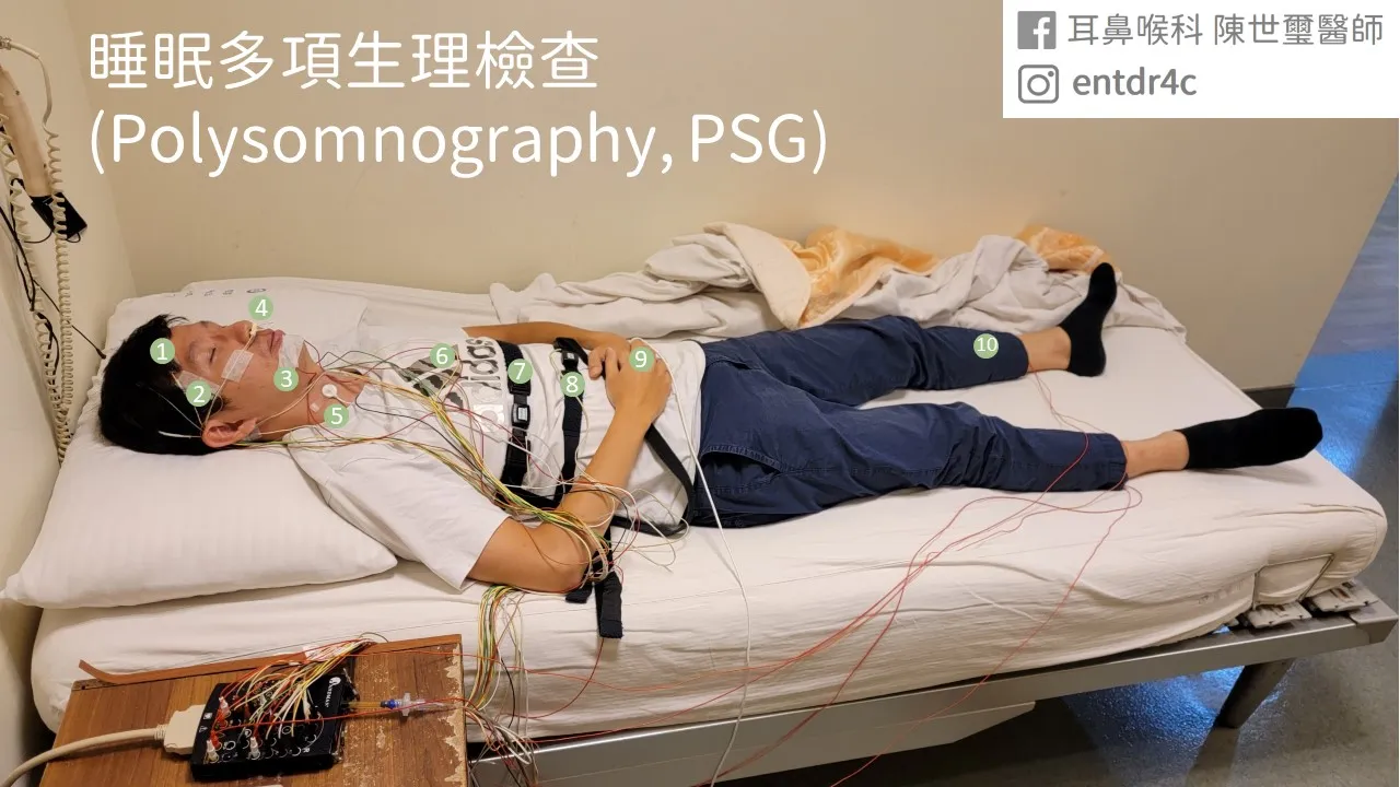 多項睡眠生理檢查