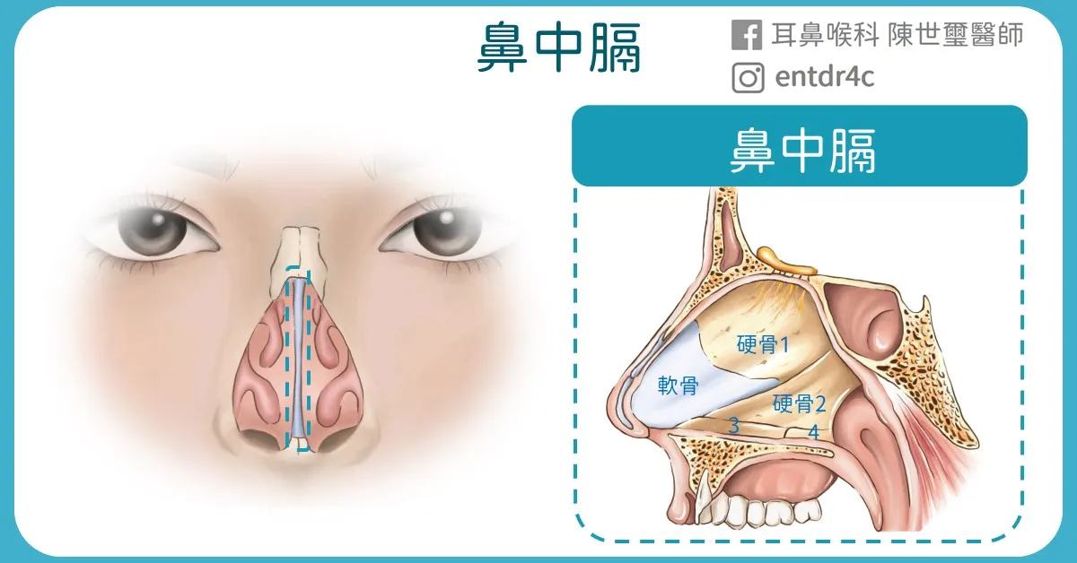 01 鼻中膈解剖圖